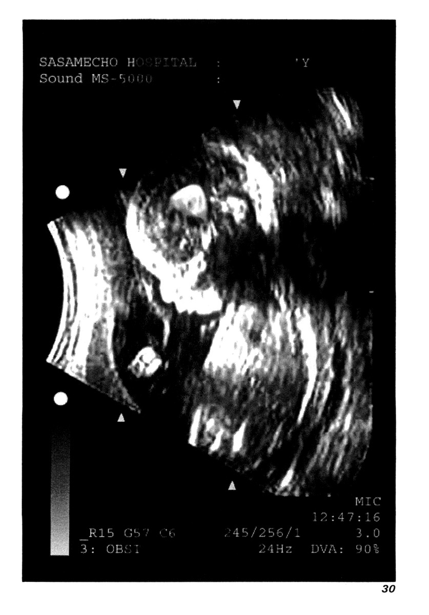 Elfen Lied chapter 72 page 34